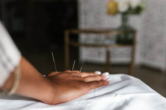 Acupuntura