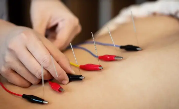 Electrolipólisis