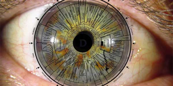 iridologia